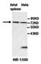 Interleukin 1 Receptor Type 1 antibody, orb77817, Biorbyt, Western Blot image 