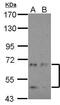Cyclin Dependent Kinase Like 3 antibody, GTX103512, GeneTex, Western Blot image 