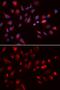 Cholinergic Receptor Muscarinic 5 antibody, GTX53955, GeneTex, Immunocytochemistry image 
