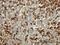 Fibrinogen Gamma Chain antibody, H00002266-M01, Novus Biologicals, Immunohistochemistry paraffin image 