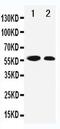 Cyclin Dependent Kinase Inhibitor 1C antibody, PA5-79028, Invitrogen Antibodies, Western Blot image 