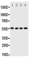 Solute Carrier Family 2 Member 5 antibody, PA2064, Boster Biological Technology, Western Blot image 