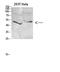 Inhibitor Of Nuclear Factor Kappa B Kinase Regulatory Subunit Gamma antibody, STJ98722, St John