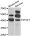 Synaptonemal Complex Central Element Protein 1 antibody, PA5-77174, Invitrogen Antibodies, Western Blot image 