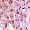 Cyclin D1 antibody, LS-C358448, Lifespan Biosciences, Immunohistochemistry paraffin image 