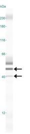 5-Hydroxytryptamine Receptor 1D antibody, GTX13895, GeneTex, Western Blot image 