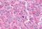 Adhesion G Protein-Coupled Receptor E3 antibody, NLS1669, Novus Biologicals, Immunohistochemistry paraffin image 