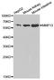 Matrix Metallopeptidase 13 antibody, A1606, ABclonal Technology, Western Blot image 