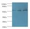 Activin A Receptor Type 1C antibody, MBS1496421, MyBioSource, Western Blot image 
