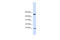 ATP Synthase Inhibitory Factor Subunit 1 antibody, ARP48451_P050, Aviva Systems Biology, Western Blot image 