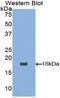 Neurotrophin 4 antibody, MBS2016522, MyBioSource, Western Blot image 
