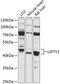 Left-Right Determination Factor 2 antibody, 15-353, ProSci, Western Blot image 