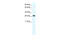 Four And A Half LIM Domains 1 antibody, 28-070, ProSci, Western Blot image 