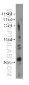 G Protein Subunit Beta 3 antibody, 15388-1-AP, Proteintech Group, Western Blot image 