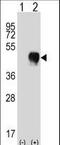 Fc Fragment Of IgG Receptor IIa antibody, LS-C166102, Lifespan Biosciences, Western Blot image 