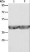 Aldolase, Fructose-Bisphosphate A antibody, LS-C400543, Lifespan Biosciences, Western Blot image 