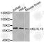 Kelch Like Family Member 13 antibody, A9989, ABclonal Technology, Western Blot image 