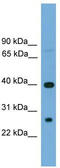 TREML2 antibody, TA338679, Origene, Western Blot image 