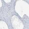 Scm Polycomb Group Protein Like 1 antibody, PA5-57206, Invitrogen Antibodies, Immunohistochemistry paraffin image 