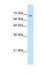 Transmembrane 9 Superfamily Member 1 antibody, NBP1-62532, Novus Biologicals, Western Blot image 