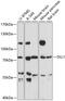 Delta Like Canonical Notch Ligand 1 antibody, 15-463, ProSci, Western Blot image 