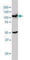 Phosphoribosylglycinamide Formyltransferase, Phosphoribosylglycinamide Synthetase, Phosphoribosylaminoimidazole Synthetase antibody, H00002618-M01, Novus Biologicals, Western Blot image 