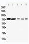 Solute Carrier Family 5 Member 1 antibody, LS-C313520, Lifespan Biosciences, Western Blot image 