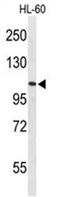 AF4/FMR2 Family Member 4 antibody, AP50103PU-N, Origene, Western Blot image 