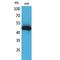 Interleukin 5 Receptor Subunit Alpha antibody, LS-C386975, Lifespan Biosciences, Western Blot image 