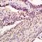 Absent In Melanoma 2 antibody, orb101275, Biorbyt, Immunohistochemistry paraffin image 