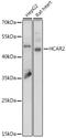 Hydroxycarboxylic Acid Receptor 2 antibody, A02511, Boster Biological Technology, Western Blot image 