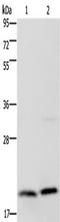 MCTS1 Re-Initiation And Release Factor antibody, TA350160, Origene, Western Blot image 