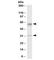 Solute Carrier Family 17 Member 5 antibody, R33800-100UG, NSJ Bioreagents, Western Blot image 