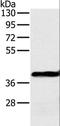 Ornithine Carbamoyltransferase antibody, LS-C405221, Lifespan Biosciences, Western Blot image 