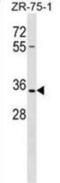 Olfactory Receptor Family 2 Subfamily L Member 8 (Gene/Pseudogene) antibody, abx029675, Abbexa, Western Blot image 