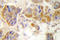 Collagen Type I Alpha 2 Chain antibody, LS-C176406, Lifespan Biosciences, Immunohistochemistry paraffin image 