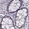 Membrane Palmitoylated Protein 5 antibody, NBP1-83716, Novus Biologicals, Immunohistochemistry paraffin image 