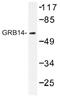 Growth Factor Receptor Bound Protein 14 antibody, AP01405PU-N, Origene, Western Blot image 