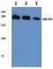 ATP Binding Cassette Subfamily A Member 8 antibody, A08490, Boster Biological Technology, Western Blot image 