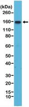 CD49D antibody, NBP2-61560, Novus Biologicals, Western Blot image 