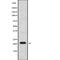 Autoimmunogenic cancer/testis antigen NY-ESO-2 antibody, PA5-68128, Invitrogen Antibodies, Western Blot image 