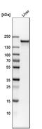 Carbamoyl-Phosphate Synthase 1 antibody, HPA021400, Atlas Antibodies, Western Blot image 