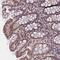 Zinc Finger CCCH-Type Containing 4 antibody, NBP1-88474, Novus Biologicals, Immunohistochemistry paraffin image 
