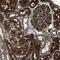 PHD Finger Protein 11 antibody, PA5-53477, Invitrogen Antibodies, Immunohistochemistry frozen image 