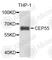 Centrosomal Protein 55 antibody, A8229, ABclonal Technology, Western Blot image 
