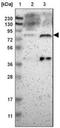 Ecdysoneless Cell Cycle Regulator antibody, NBP2-33278, Novus Biologicals, Western Blot image 