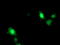 ADP Ribosylation Factor Like GTPase 11 antibody, M11959, Boster Biological Technology, Immunofluorescence image 