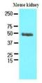 Proteasome 26S Subunit, Non-ATPase 11 antibody, NBP1-30252, Novus Biologicals, Western Blot image 