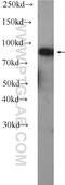 Complement C4 antibody, 22233-1-AP, Proteintech Group, Western Blot image 