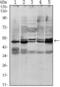 SMAD Family Member 3 antibody, GTX82809, GeneTex, Western Blot image 